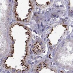 Tripeptidyl-Peptidase I/TPP1 Antibody, Novus Biologicals:Antibodies:Primary