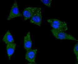 TrkA Antibody (JJ084-04), Novus Biologicals 100&mu;L:Antibodies, Monoclonal