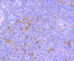 TrkA Antibody (JJ084-04), Novus Biologicals 100&mu;L:Antibodies, Monoclonal