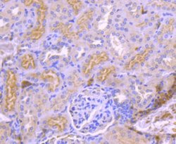 TrkA Antibody (JJ084-04), Novus Biologicals 100&mu;L:Antibodies, Monoclonal