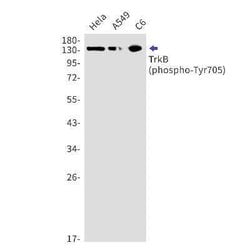 TrkB Rabbit anti-Human, Mouse, Rat, Clone: S04-6B1, Novus Biologicals:Antibodies:Primary
