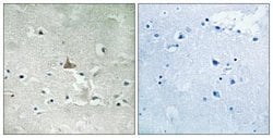 TrkB, p Tyr707, p Tyr706 Antibody - BSA Free, Novus Biologicals:Antibodies:Primary