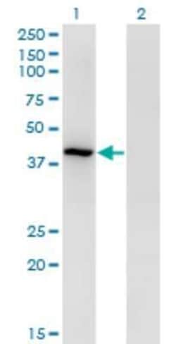 Tropomodulin 3 Antibody (1E1), Novus Biologicals 0.1 mg, Unconjugated:Antibodies,
