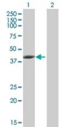 Tropomodulin 3 Antibody, Novus Biologicals 0.05 mg | Buy Online | Novus Biologicals | Fisher Scientific