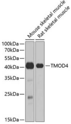 Tropomodulin 4 Antibody - BSA Free, Novus Biologicals:Antibodies:Primary