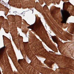 Tropomyosin-1 Antibody, Novus Biologicals 0.1 mL, Unconjugated:Antibodies,