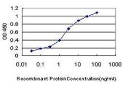 Troponin C (cardiac) Antibody (1F8-A9), Novus Biologicals 0.1 mg | Buy Online | Novus Biologicals | Fisher Scientific