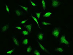 Troponin C (cardiac) Antibody, Novus Biologicals™