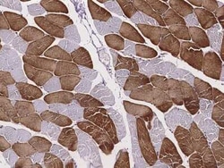 Troponin C (cardiac) Antibody, Novus Biologicals:Antibodies:Primary Antibodies