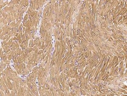 Troponin C (cardiac) Antibody, Novus Biologicals:Antibodies:Primary Antibodies