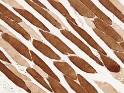 Troponin C (cardiac) Antibody, Novus Biologicals 50 &mu;g; Unconjugated:Antibodies,