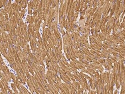 Troponin C (cardiac) Antibody, Novus Biologicals:Antibodies:Primary Antibodies
