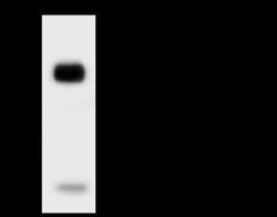 Troponin C (cardiac) Antibody, Novus Biologicals:Antibodies:Primary Antibodies