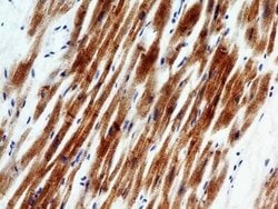 Troponin I Type 3 (cardiac) Antibody (1E10) - Azide and BSA Free, Novus Biologicals 0.1 mg | Buy Online | Novus Biologicals | Fisher Scientific