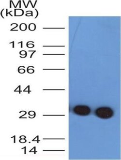 Troponin I Type 3 (cardiac) Antibody (1E10) - Azide and BSA Free, Novus Biologicals 0.1 mg | Buy Online | Novus Biologicals | Fisher Scientific