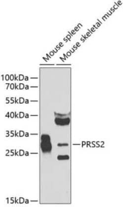 Trypsin 2/PRSS2 Antibody - BSA Free, Novus Biologicals:Antibodies:Primary