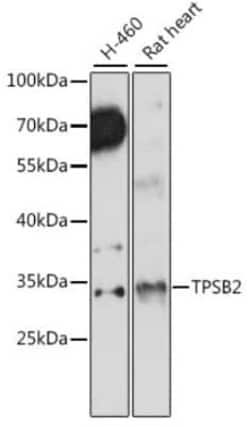 Tryptase beta-2/TPSB2 Antibody - Azide and BSA Free, Novus Biologicals
