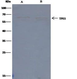 Tryptophan Hydroxylase 1/TPH-1 Rabbit anti-Human, Clone: 145, Novus Biologicals