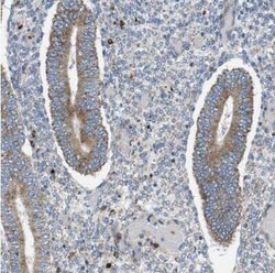 Tryptophan Hydroxylase 1/TPH-1 Antibody, Novus Biologicals:Antibodies:Primary