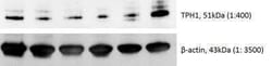 Tryptophan Hydroxylase 1/TPH-1 Antibody, Novus Biologicals:Antibodies:Primary