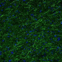 Tryptophan hydroxylase 2 Antibody (CL2990), Novus Biologicals:Antibodies:Primary