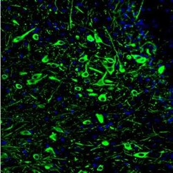 Tryptophan hydroxylase 2 Antibody (CL2990), Novus Biologicals:Antibodies:Primary