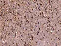 Tubby Antibody, Novus Biologicals:Anticuerpos:Anticuerpos primarios