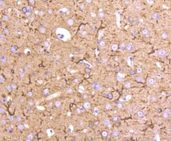 TubulinBeta2C Rabbit anti-Human, Clone: ST52-04, Novus Biologicals 100&mu;L:Antibodies,