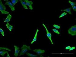 Tubulin alpha-1B Antibody (2E8), Novus Biologicals 0.1 mg | Buy Online | Novus Biologicals | Fisher Scientific