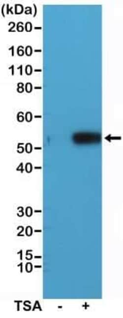 Tubulin alpha-1B, ac Lys40 Antibody (RM318), Novus Biologicals 100 &mu;g;
