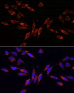 DAP Kinase 2 Rabbit anti-Human, Mouse, Rat, Polyclonal, Novus Biologicals:Antibodies:Primary