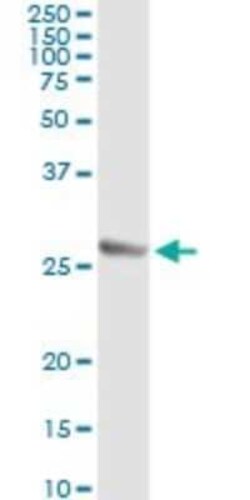 Twist-1 Antibody (3E11), Novus Biologicals 0.1 mg, Unconjugated:Antibodies,