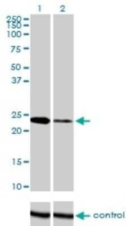 Twist-1 Antibody (3E11), Novus Biologicals 0.1 mg, Unconjugated:Antibodies,