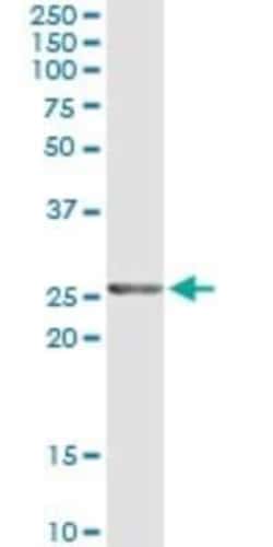 Twist-2 Antibody (3C12), Novus Biologicals 0.1 mg | Buy Online | Novus Biologicals | Fisher Scientific