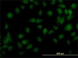 Tyk2 Antibody (5A4), Novus Biologicals 0.1 mg | Buy Online | Novus Biologicals | Fisher Scientific