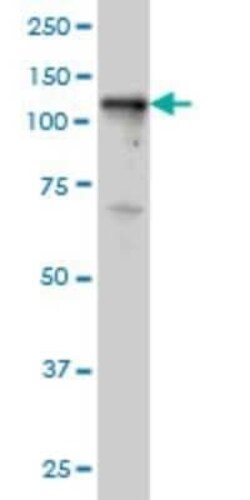 Tyk2 Antibody (5A4), Novus Biologicals 0.1 mg | Buy Online | Novus Biologicals | Fisher Scientific
