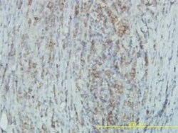 Tyk2 Antibody (6H1), Novus Biologicals 0.1 mg | Buy Online | Novus Biologicals | Fisher Scientific