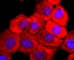 Tyrosinase Antibody (JA52-11), Novus Biologicals 100&mu;L:Antibodies, Monoclonal