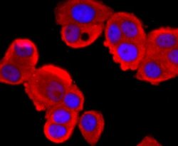 Tyrosinase Antibody (JA52-11), Novus Biologicals 100&mu;L:Antibodies, Monoclonal
