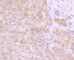 Tyrosinase Antibody (JA52-11), Novus Biologicals 100&mu;L:Antibodies, Monoclonal