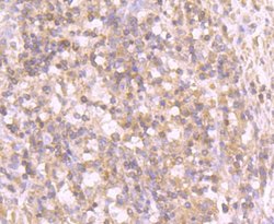 Tyrosinase Antibody (JA52-11), Novus Biologicals 100&mu;L:Antibodies, Monoclonal