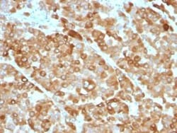 Tyrosinase Antibody (OCA1/812), Novus Biologicals:Antibodies:Primary Antibodies