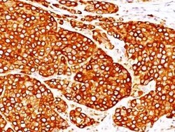 Tyrosinase Antibody (T311 + OCA1/812), Novus Biologicals:Antibodies:Primary