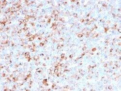 Tyrosinase Antibody (T311 + OCA1/812), Novus Biologicals:Antibodies:Primary