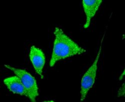 Tyrosine Hydroxylase Antibody (SN59-03), Novus Biologicals 100&mu;L:Antibodies,