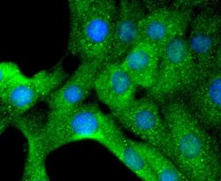Tyrosine Hydroxylase Antibody (SN59-03), Novus Biologicals 100&mu;L:Antibodies,