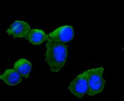 Tyrosine Hydroxylase Antibody (SN59-03), Novus Biologicals 100&mu;L:Antibodies,