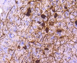 Tyrosine Hydroxylase Antibody (SN59-03), Novus Biologicals 100&mu;L:Antibodies,