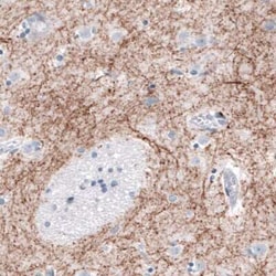 Tyrosine Hydroxylase Antibody (CL3049), Novus Biologicals:Antibodies:Primary
