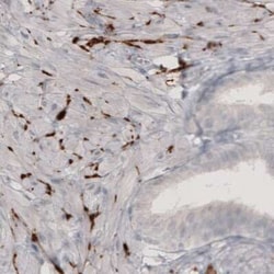 Tyrosine Hydroxylase Antibody (CL3049), Novus Biologicals:Antibodies:Primary